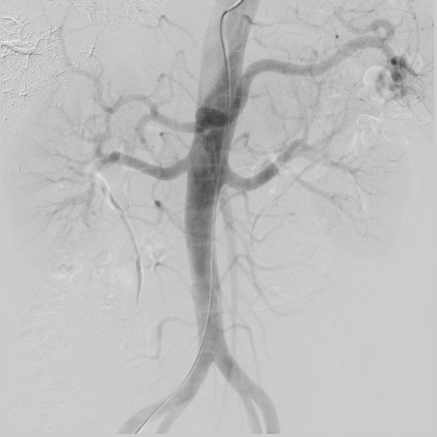 CATHLAB.jpg CATHLAB.jpg